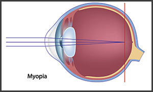 turnersville eye doctor