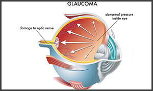 eye exam in turnersville