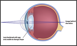 eye doctor in turnersville