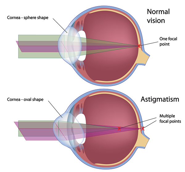 eye exams in turnersville